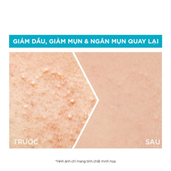 Tinh Chất Garnier Giảm Mụn Mờ Thâm Cho Da Dầu, Mụn 30ml 
